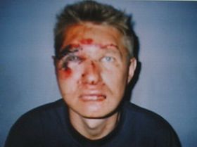 Избитый милиционером, Фото прислано ЗПЦ для Каспарова.Ru Избитый милиционером, Фото прислано ЗПЦ для Каспарова.Ru